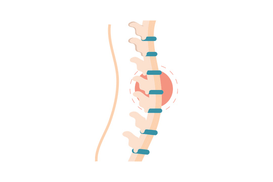 lumbar_spine